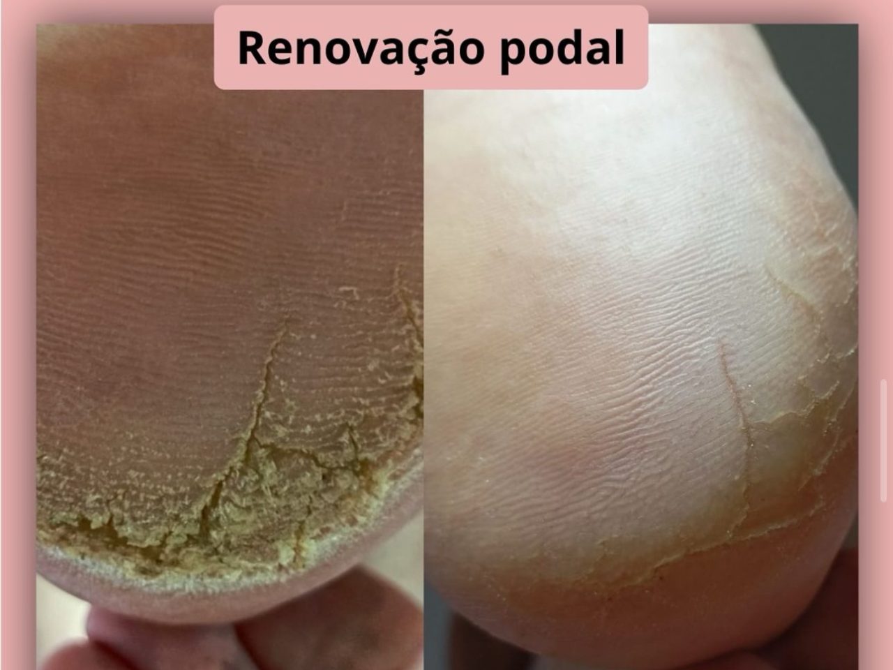 Van Podóloga